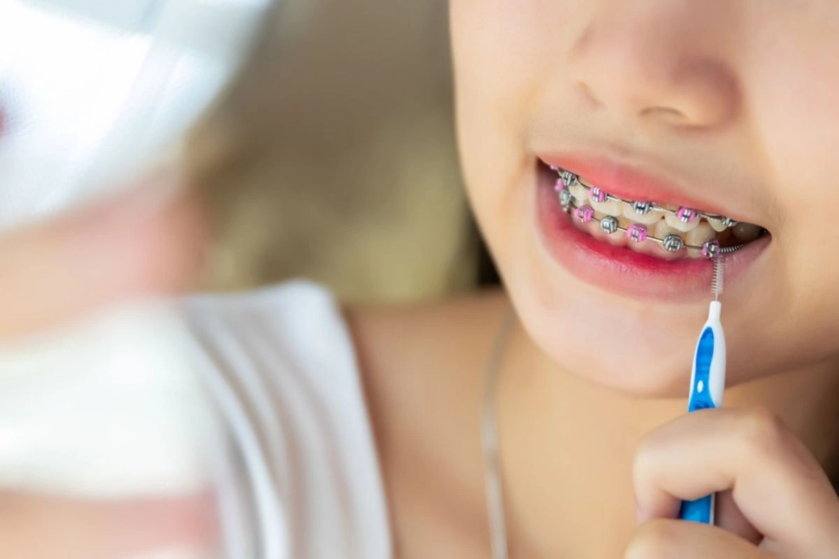 Names for Braces